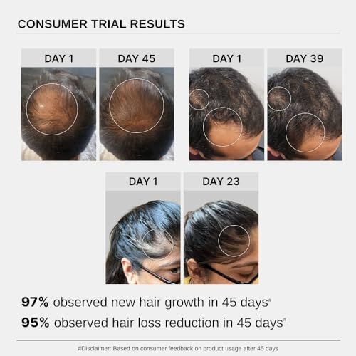 Bare Anatomy Advanced Hair Growth Serum | 3% Redensyl + 4% Anagain + 3% Baicapil + 1% Capilia Longa, Rosemary, Biotin & Rice Extract | Hair growth & Hair fall control serum for Women & Men | 30mL