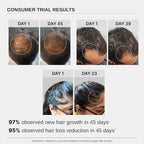Bare Anatomy Advanced Hair Growth Serum | 3% Redensyl + 4% Anagain + 3% Baicapil + 1% Capilia Longa, Rosemary, Biotin & Rice Extract | Hair growth & Hair fall control serum for Women & Men | 30mL