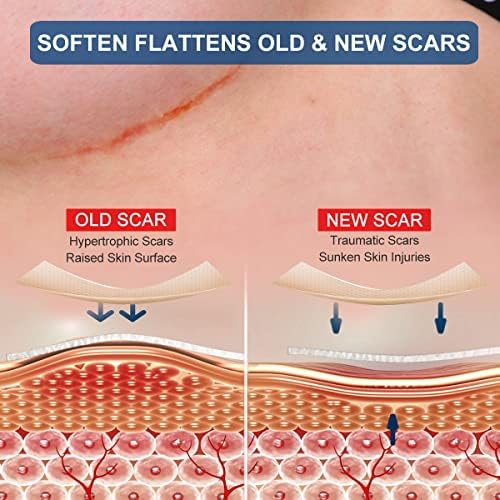 Silicone Scar Sheets for Breast - 8 Pack, Including 4 Areola Soft Strips & 4 Anchor Sheets