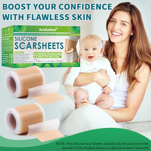 Silicone Scar Sheets, Silicone Scar Tape, Scar Sheets for Surgical Scars, Reusable Silicone Scar Strip For Surgical, C-Section,Tummy Tuck, Keloid Scars, Burn, Acne, Removal (1.6"X 108" Roll-3M)