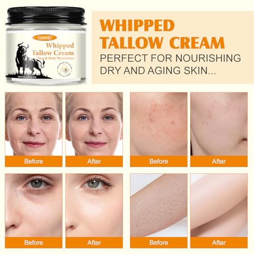 Beef Tallow for Skin, 2Pcs Tallow Face Moisturizer, Natural Grass-Fed Grass Finished Beef Tallow and Honey Balm Deeply Moisturizing for Face & Body