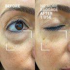 Dr. Brandt Needles No More, No More Baggage - Minimizes Under-Eye Bags, Puffiness & Dark Circles - 0.23 oz
