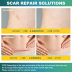 Silicone Scar Sheets (1.6" x 120" Roll-3M), Silicone Scar Tape for Scar Removal Treatment, Silicone Scar Removal Strips for Surgical, C-Section, Tummy Tuck, Keloid Bump Removal