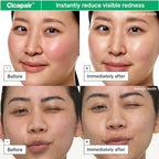 Dr.Jart+ Cicapair™ Sensitive Skin Face Moisturizer for Redness and Barrier Repair with Centella Asiatica | Korean Skin Care