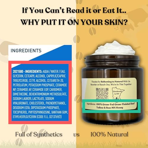 Beef Tallow for Skin | 100% Grass-Fed Tallow & Raw MN Honey | 2 Ingredients | Whipped & UNSCENTED | Whole Body & Face Balm for Sensitive, Dry Skin, Eczema, Psoriasis, Rosacea (4oz)