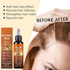 Batana Oil for Hair Growth, 4-in-1 Liquid Batana Oil, with Rosemary Oil Castor Oil Pumpkin Seed Oil,for All Hair Types,3.38 fl oz(1pcs)