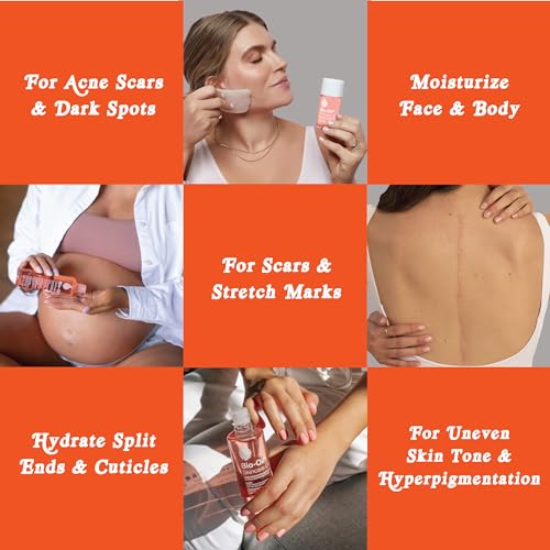 Bio-Oil Skincare Body Oil Serum for Scars and Stretch Marks, Face and Body Moisturizer with Vitamin E & A for Sensitive Dry Skin, Dermatologist Recommended, Travel Size, .85 oz, Pack of 3