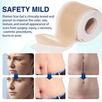 Silicone Scar Sheets (1.6”x 130”, 3.3M), Professional Silicone Scar Tape, Silicone Scar Strips, Reusable Scar Removal Sheets for Surgical Scars, C-Section, Surgery, Burn, Keloid, Acne