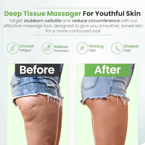 Detachable Cellulite Massager Roller for Full Body Massage & Skin Firming - Cellulitis Treatment for legs, Neck, Waist & Buttocks - Fascia Massage Tool for Lymphatic Drainage & Deep Tissue Pain Relief