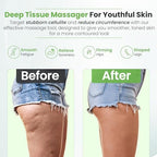 Detachable Cellulite Massager Roller for Full Body Massage & Skin Firming - Cellulitis Treatment for legs, Neck, Waist & Buttocks - Fascia Massage Tool for Lymphatic Drainage & Deep Tissue Pain Relief