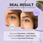 Excuse My Frank Bakuchiol Age Defense Eyecream,Korean Eye Cream, Fragrance, Gentle Cream, Natural Retinol, Dark Circles Puffiness & Firming, Anti Aging, Wrinkle Care, Fragrance Free, Vegan1.01fl oz