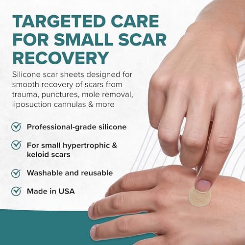Epi-Derm Epi-Tab Circles Silicone Scar Sheets – Professional-Grade, Washable & Reusable Silicone Patches for Small Hypertrophic & Keloid Scars from Trauma, Liposuction & More - Natural, 6-Pack