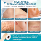 Silicone Scar Sheets, Silicone Scar Tape(1.8”x 157” Roll-4M), Silicone Scar Strips, Professional Scar Removal Sheets for Surgical Scars, Keloid, C-Section, Burn et