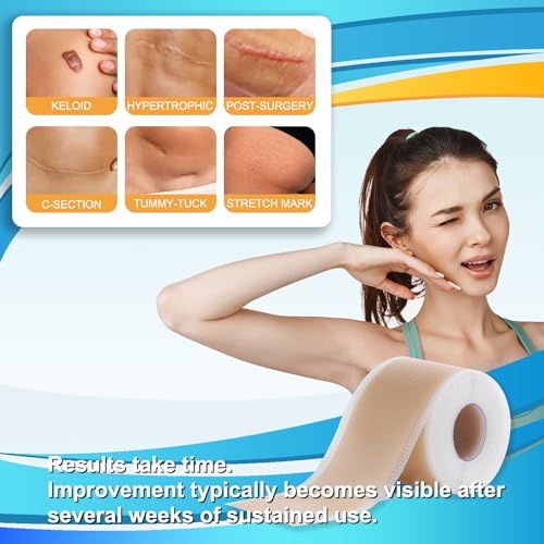 Medical Grade Silicone Scar Tape for Surgical Scars (1.6" x 120" - 3M) Professional Silicone Scar Sheets Scar Treatment for Face Wrinkles, C Section Recovery, Keloid Bump Removal Silicone Scar Patches