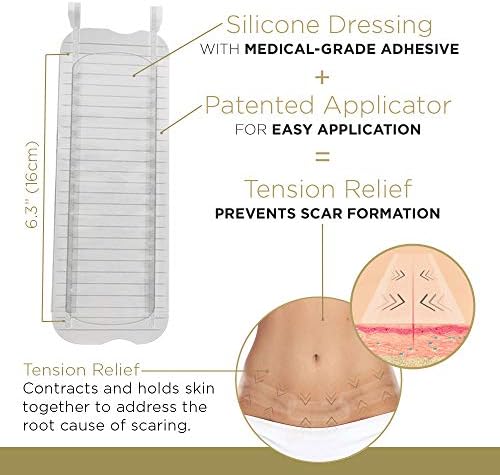 Embrace Active Scar Defense for New Tummy Tuck Scars, FDA-Cleared Extra-Large Silicone Scar Sheets, 30 Day Supply