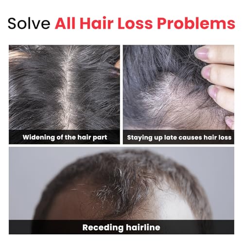Laser Therapy Hair Growth Comb,Red Light Therapy for Hair Growth,LED Electric Scalp Massager,Red Light Hair Brush,Suitable for Men and Women with Thinning Hair and Hair loss.