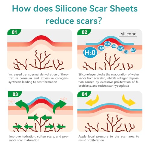 Dimora Medical Grade Silicone Scar Sheets - Ultra Soft Silicone Scar Tape (1.6”x120" Roll), Waterproof Scar Treatment for Surgical Scars, C Section, Tummy Tuck, Keloid Treatment