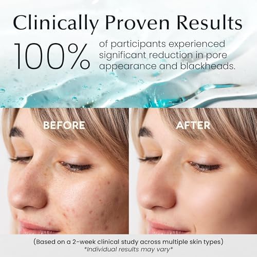 Witch Hazel & Centella Daily Toner Pads - 100 Ct | Hydrating, Exfoliating & Pore Care Korean Skincare - Gentle, Alcohol-Free, with Glycerin for Sensitive Skin by La Pure Cosmetics