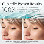 Witch Hazel & Centella Daily Toner Pads - 100 Ct | Hydrating, Exfoliating & Pore Care Korean Skincare - Gentle, Alcohol-Free, with Glycerin for Sensitive Skin by La Pure Cosmetics