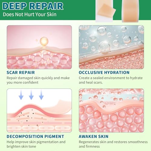 Silicone Scar Sheets, Silicone Scar Tape, Scar Sheets for Surgical Scars, Reusable Silicone Scar Strip For Surgical, C-Section,Tummy Tuck, Keloid Scars, Burn, Acne, Removal (1.6"X 108" Roll-3M)