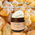 Frankincense Tallow Face Moisturizer – 100% Grass-Fed Whipped Beef Tallow Balm for Dry, Sensitive Skin, Eczema & Psoriasis – Handmade Natural Skincare – 2 oz