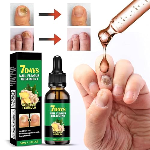 7days Nail Treatment, Ginger Nail Treatment,Nail Support Nail Care,Ginger Nail Growth Serum, Ginger Cuticle Care Oil for Nails (3PCS)
