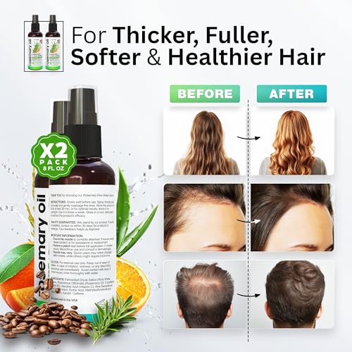 Rosemary Oil and Rice Water Hair Growth Spray - Serum with Biotin, Keratin, Caffeine, Vitamins C & B5 for Hair Mask, Hair Care, Scalp Treatment, Thickening Dry Damaged Hair for Women & Men 8oz