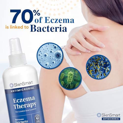 SkinSmart Antimicrobial Eczema Therapy with Hypochlorous Acid, Removes Bacteria so Skin Can Heal, for Adults, Kids and Seniors, 8 Ounce Clear Spray