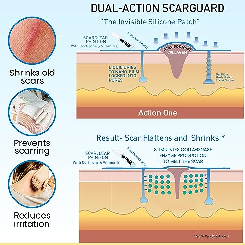 Invisible Brush-On Silicone Sheet with Vitamin E - Scar Removal for Keloids, Burn Scars, Surgery Scars, Stitches, Cuts - No Ugly Scar Sheets, Cream or Messy Scar Gel Needed