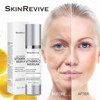 SkinRevive Super Vitamin C Serum for Women over 70, Vitamin C Serum for Mature Skin Face Hydrates, Firms, Lifts, Targets Age Marks, Wrinkles and Smoothes Skin Texture 1.69 fl oz