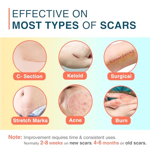 Silicone Scar Sheets, 1.5” x 156” Medical Silicone Scar Tape Roll, Reusable Scar Strips for Surgical, C-Section, Keloid Bump, Stretch Marks, Acne, Hypertrophic Scar Treatment