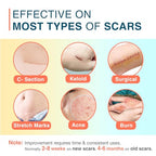 Silicone Scar Sheets, 1.5” x 156” Medical Silicone Scar Tape Roll, Reusable Scar Strips for Surgical, C-Section, Keloid Bump, Stretch Marks, Acne, Hypertrophic Scar Treatment