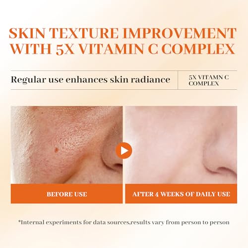 Advanced Vitamin C Gloss Serum - Stabilized Complex with Hyaluronic Acid & Centella | Hydrating Facial Essence for Dullness & Uneven Texture, Sensitive Skin-Friendly Formula, 1 fl oz