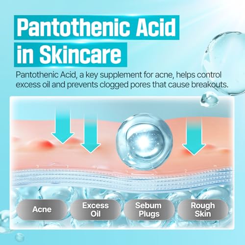 numbuzin No.1 Cream | Pantothenic B5 Active Soothing Cream | Lightweight Hydrating Moisturizer, Pantothenic Acid, Niacinamide | Excess Oil Control, Soothes Acne | Non-Comedogenic | 2.70 fl. oz.