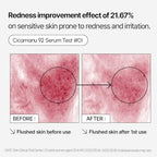 Parnell Cicamanu 92 Serum - Melatonin, Centella Asiatica, Ceramide and Overnight Recovery Moisturizing Ampoule for Hyperpigmentation and Soothing Irritated Skin (1.01 Fl Oz / 30ml)