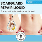 Invisible Brush-On Silicone Sheet with Vitamin E - Scar Removal for Keloids, Burn Scars, Surgery Scars, Stitches, Cuts - No Ugly Scar Sheets, Cream or Messy Scar Gel Needed