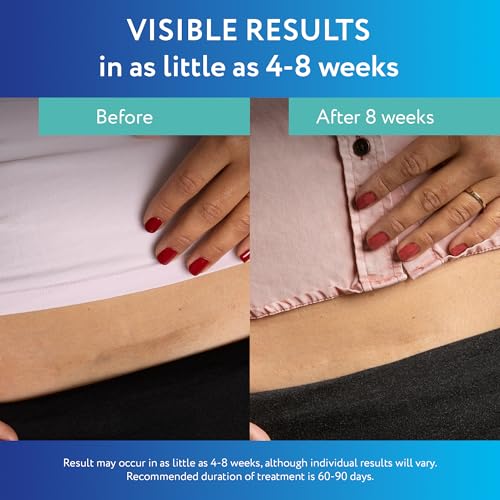 ScarAway Advanced Clear Silicone Scar Sheets, Medical Grade Silicone Strips (1.5" x 3") Scar Treatment and Prevention for Surgical, Burn, Body, Hypertrophic & Keloid Scar Treatment, 10 Clear Sheets
