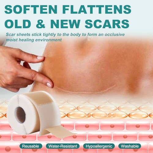 Silicone Scar Sheets, Silicone Scar Tape(1.6"x 79"), Professional Scar Removal Treatment, Reusable Silicone Scar Strips for Keloids, Surgeries Scars, C-sections, and Burns