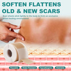 Silicone Scar Sheets, Silicone Scar Tape(1.6"x 79"), Professional Scar Removal Treatment, Reusable Silicone Scar Strips for Keloids, Surgeries Scars, C-sections, and Burns