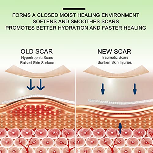 Silicone Scar Sheets, Tape, Strips, 16 Pcs 5.9"x1.6", Healing Keloid, C-Section, Tummy Tuck - As Surgical Cream, Gel, Patch, Bandage, Pad - Surgery Scars Treatment, Scar Remover.
