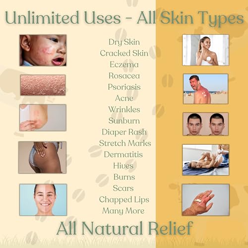 Beef Tallow for Skin | TALLOW HONEY BALM | 2 Ingredients | 100% Grass-Fed Tallow & Raw MN Honey | Whipped & UNSCENTED | Whole Body & Face Balm for Sensitive, Dry Skin, Eczema, Psoriasis, Rosacea (2oz)