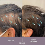 DS Laboratories Spectral.CSF Hair Regrowth Treatment for Women - Biotin Serum for Hair Growth, Thinning, and Thickening