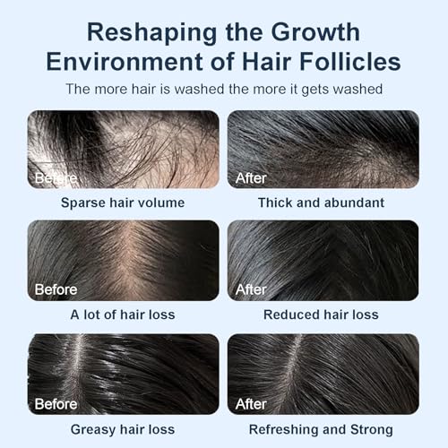 Organic Biotin Rosemary Hair Growth Shampoo for Women & Men- Thickening Shampoo with Amino Acid for Hair Loss-Dandruff Shampoo for Oily Hair and Scalp