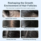 Organic Biotin Rosemary Hair Growth Shampoo for Women & Men- Thickening Shampoo with Amino Acid for Hair Loss-Dandruff Shampoo for Oily Hair and Scalp