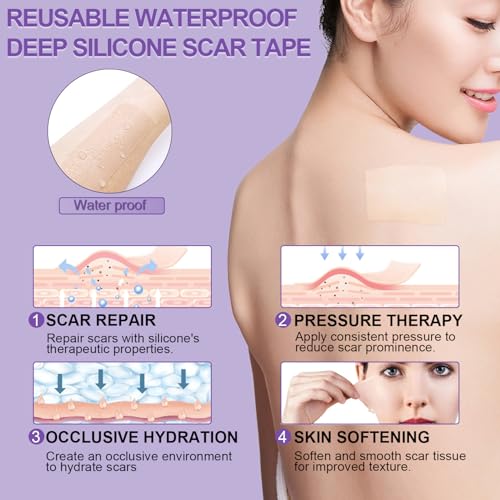 Silicone Scar Sheets, Medical Grade Silicone Scar Tape (1.6" x 120"), Professional Scar Removal Treatment, Reusable, for Healing Keloids, Surgeries Scars, C-sections, and Burns