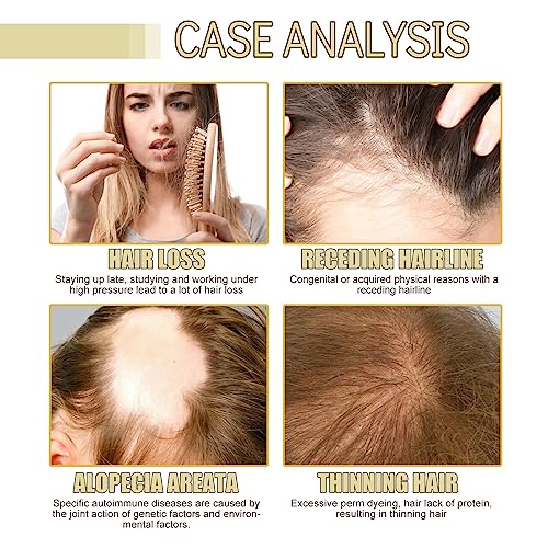 180 ML HuaQing Veganic Natural Hair Growth Oil, Eelhoe Hair Growth Organic Rosemary Hair Oil for Damaged Hair.(3 Pcs)