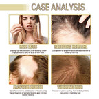 180 ML HuaQing Veganic Natural Hair Growth Oil, Eelhoe Hair Growth Organic Rosemary Hair Oil for Damaged Hair.(3 Pcs)