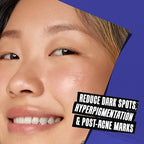 Kiehl's Clearly Corrective Dark Spot Serum, Brightening Facial Serum, Reduces Hyperpigmentation & Post-acne Marks, with Vitamin C & Salicylic Acid, All Skin Types, Paraben-free, Mineral Oil-free