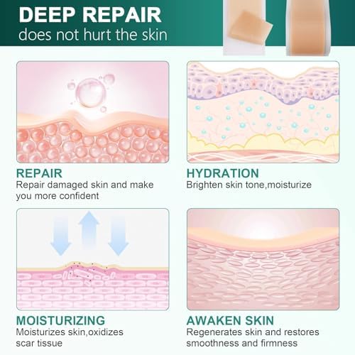 Silicone Scar Sheets, Silicone Scar Tape (1.6"x 120" Roll-3M), Reusable and Effective Scar Removal Sheets, Silicone Scar Removal Sheets for Surgical Scars, Healing Keloid, C-Section, Tummy Tuck