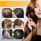 Onest Cosmetics Anti-Greying Hair Growth Oil, Onestcosmetics Anti Greying Hair Growth Oil Enriched with Amla and Sunflower,Onestcosmetic Rosemary Hair Oil Serum Anti Hair Loss Nourishing Serum